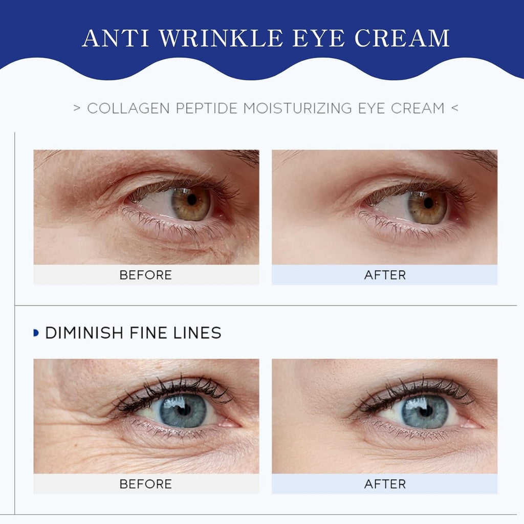 Collagen Peptides Eye Cream, Moisturizing Collagen Eye Cream, anti Wrinkle Eye Serum Moisturizer with Hydrolyzed Collag-En, to Reduce Puffiness, Dark Circle, Crows Feet and Eye Bag, All Skin Types