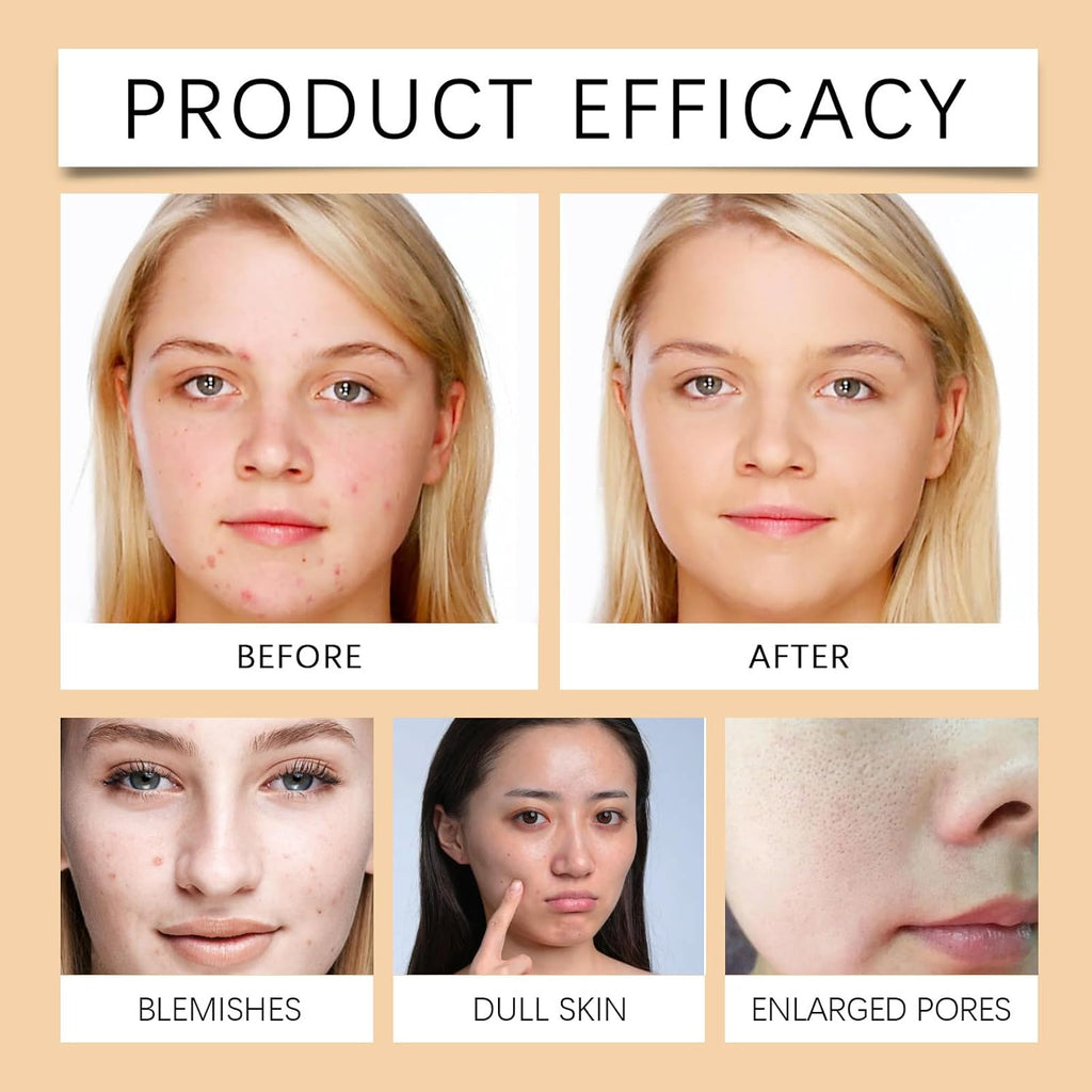 Salicylic Acid Cleanser - Face Wash for Deep Cleansing - Scrub Face Cleanser for Pore Purifying - Exfoliating Facial Cleanser - Korean Skincare Face Cleanser Women - Hydrating Cleanser for Dry Skin