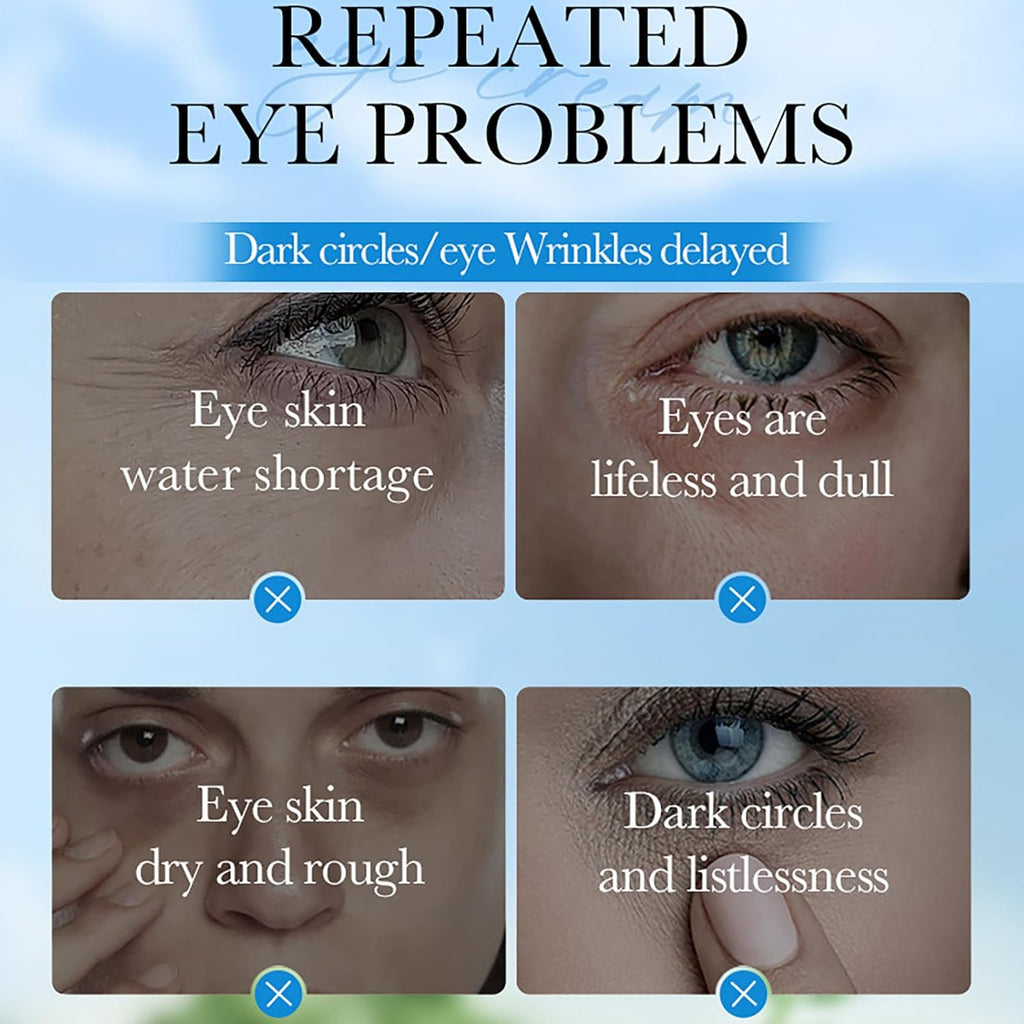 Coconut Eye Cream anti Aging - Eye Cream for Dry Skin - anti Wrinkle Eye Cream for Dark Circles and Puffy Eyes - Hydrating Eye Cream - Eye Care Products - Eye Moisturiser for Moisturizing, Nourishing