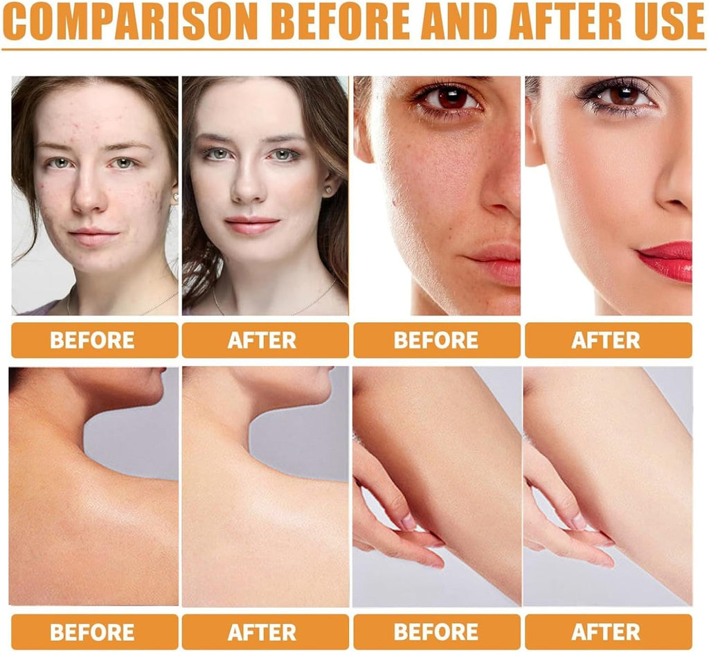 2Pcs Turmeric Face Cream and Turmeric Soap Bar Set for Face & Body, Turmeric Skin Care Set, Turmeric Soap and Turmeric Cream Skincare Set for Anti-Aging Glowing Skin, Soothing, Hydrating Skin