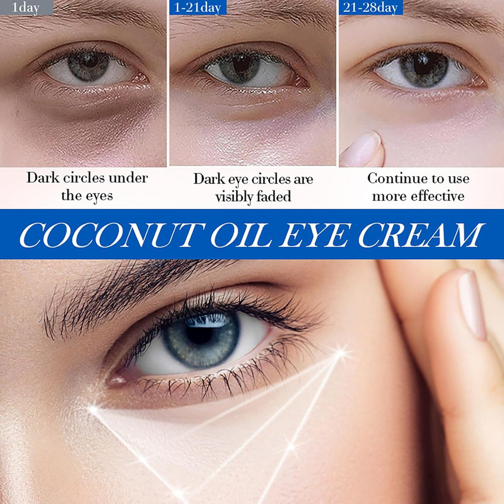 Coconut Eye Cream anti Aging - Eye Cream for Dry Skin - anti Wrinkle Eye Cream for Dark Circles and Puffy Eyes - Hydrating Eye Cream - Eye Care Products - Eye Moisturiser for Moisturizing, Nourishing