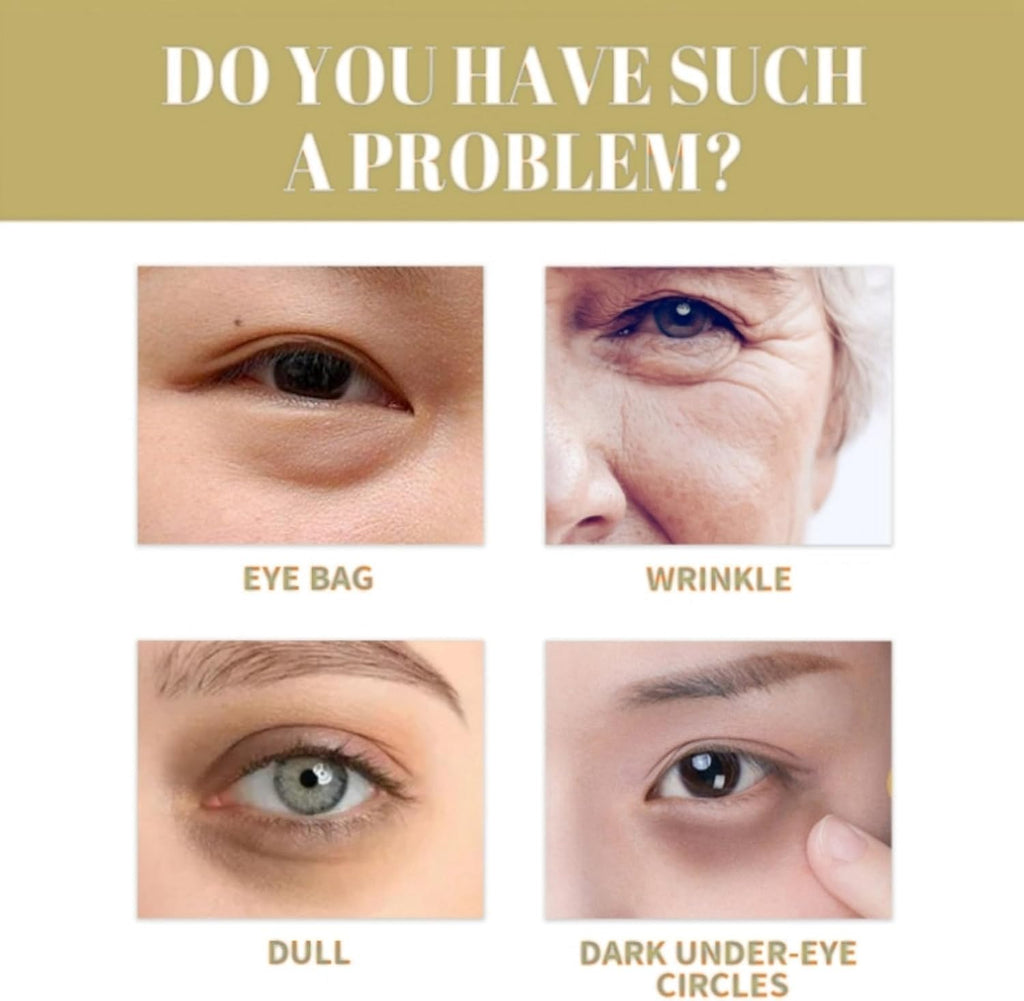 Bee Venom Eye Cream,Eye Cream for Dark Circles and Puffy Eyes,Eye Bags Remover,Anti Wrinkle Eye Cream,Caffeine Eye Cream anti Aging,Moisturizing under Eye Cream,Firming Eye Cream,Eye Bag Removal,20G